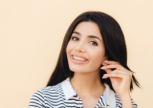 five ways braces.jpg