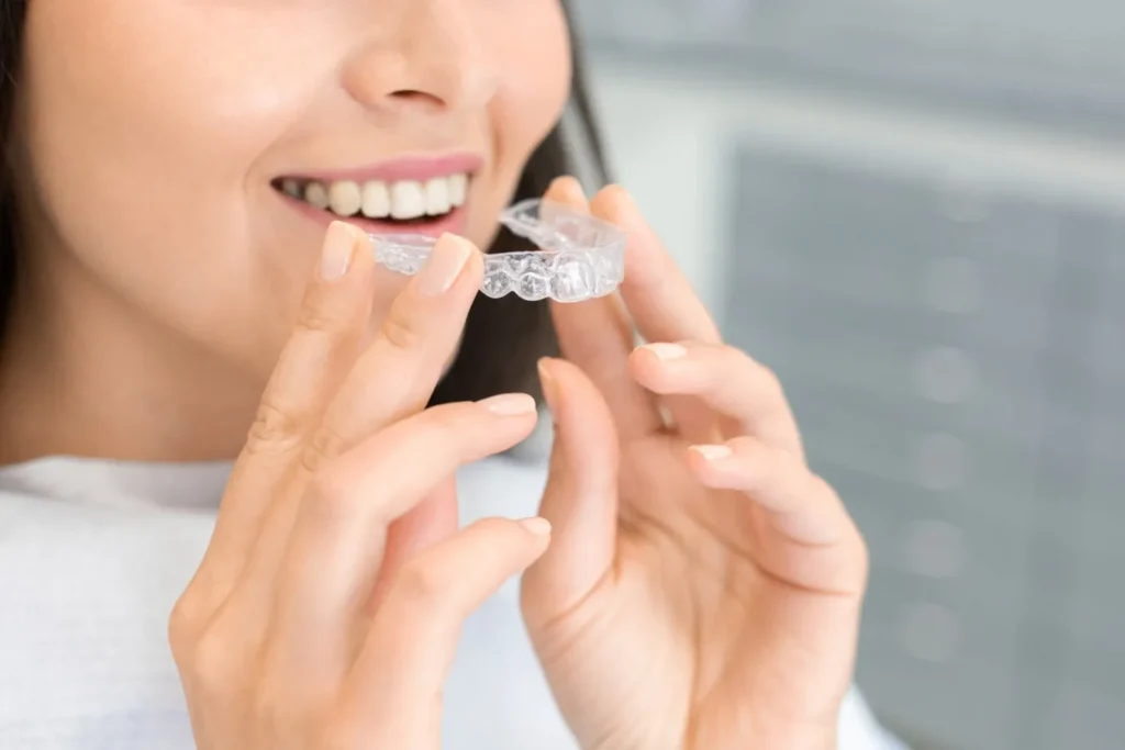 Clear Aligners for Adults.jpg